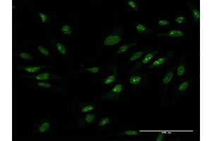 Immunofluorescence of purified MaxPab antibody to ZCCHC9 on HeLa cell. (ZCCHC9 anticorps  (AA 1-271))