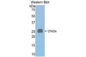 Western Blotting (WB) image for anti-Prolactin Receptor (PRLR) (AA 20-229) antibody (ABIN3203012) (Prolactin Receptor anticorps  (AA 20-229))