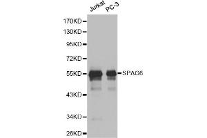 Western blot analysis of extracts of various cell lines, using SPAG6 antibody (ABIN6291215). (SPAG6 anticorps)