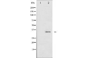 Western blot analysis of CDC2 phosphorylation expression in HepG2 whole cell lysates,The lane on the left is treated with the antigen-specific peptide.