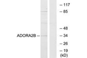 Western Blotting (WB) image for anti-Adenosine A2b Receptor (ADORA2B) (AA 231-280) antibody (ABIN2890803) (Adenosine A2b Receptor anticorps  (AA 231-280))