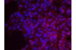Immunofluorescence (IF) image for anti-Epidermal Growth Factor Receptor (EGFR) antibody (ABIN2664938) (EGFR anticorps)