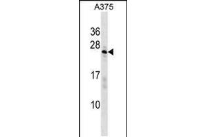 Western blot analysis in A375 cell line lysates (35ug/lane). (SARNP anticorps  (AA 81-110))