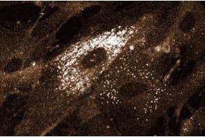 Immunofluorescent staining on Human Intestinal Smooth Muscle (HISM) cells.