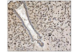 IHC analysis of TRAP Alpha/TRAPA/SSR1 using anti-TRAP Alpha/TRAPA/SSR1 antibody (ABIN7601975).