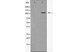 Western blot analysis of Integrin α5 (CD49e) expression in HeLa cells,The lane on the left is treated with the antigen-specific peptide. (ITGA5 anticorps  (Internal Region))