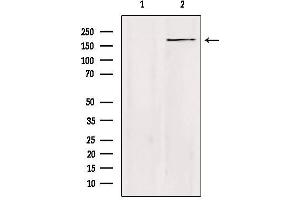 Western blot analysis of extracts from Hela, using ZC3H13 Antibody. (ZC3H13 anticorps  (C-Term))
