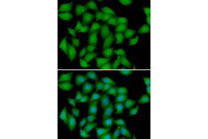 Immunofluorescence analysis of HeLa cell using ATOX1 antibody. (ATOX1 anticorps)