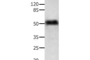 Western Blot analysis of Human lymphoma tissue using ACTG1 Polyclonal Antibody at dilution of 1:350 (Actin, gamma 1 anticorps)