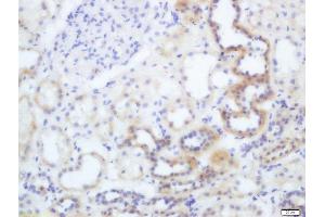 Formalin-fixed and paraffin embedded human kidney labeled with Anti-Phospho-eNOS (Thr495) Polyclonal Antibody, Unconjugated  at 1:200 followed by conjugation to the secondary antibody and DAB staining (ENOS anticorps  (pThr495))