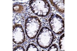 IHC analysis of HIF-1 alpha/HIF1A using anti-HIF-1 alpha/HIF1A antibody (ABIN7602159).