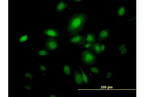 Immunofluorescence of monoclonal antibody to SEPT10 on HeLa cell. (Septin 10 anticorps  (AA 1-454))