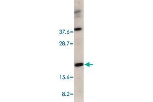 Western blot analysis of CRADD in HeLa total cell lysate with CRADD polyclonal antibody  at 1 ug/mL . (CRADD anticorps  (C-Term))