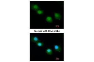 ICC/IF Image Immunofluorescence analysis of paraformaldehyde-fixed A549, using Ubiquilin-1, antibody at 1:200 dilution.