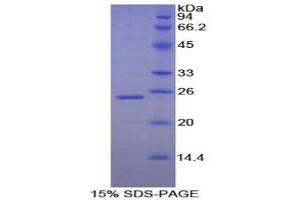 SDS-PAGE analysis of Dog Noggin Protein. (NOG Protéine)