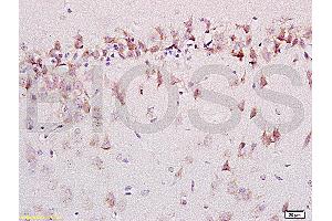 Formalin-fixed and paraffin embedded labeled with rat brain Anti-AMBRA1 Polyclonal Antibody, Unconjugated (ABIN704741) 1:200 followed by conjugation to the secondary antibody and DAB staining (AMBRA1 anticorps  (AA 221-320))