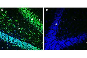 Expression of Tetraspanin 18 in mouse hippocampus. (Tetraspanin 18 anticorps  (Extracellular))