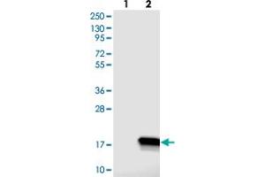 Western blot analysis of Lane 1: Negative control (vector only transfected HEK293T lysate), Lane 2: Over-expression Lysate (Co-expressed with a C-terminal myc-DDK tag (~3. (C14ORF119 anticorps)