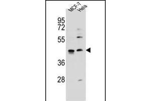 ZN Antibody (C-term) (ABIN655885 and ABIN2845286) western blot analysis in MCF-7,Hela cell line lysates (35 μg/lane). (ZNF384 anticorps  (C-Term))