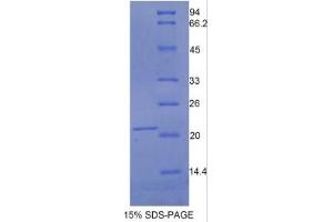 SDS-PAGE of Protein Standard from the Kit  (Highly purified E. (LIFR Kit ELISA)