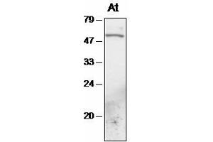Western blot analysis of Arabidopsis chloroplast proteins with anti-TAK1 (Serine/threonine Protein Kinase (At4g02630) anticorps)