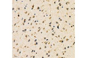 Immunohistochemistry of paraffin embedded mouse brain using ANXA3 (ABIN7073065) at dilution of 1: 200 (400x lens)
