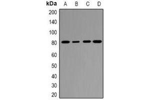 Western blot analysis of EPS8L1 expression in Hela (A), COLO205 (B), mouse uterus (C), rat placenta (D) whole cell lysates. (EPS8-Like 1 anticorps)