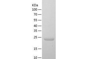 Western Blotting (WB) image for Reelin (RELN) (AA 26-254) protein (His-IF2DI Tag) (ABIN7124805)