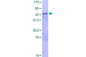 Image no. 1 for Secreted Protein, Acidic, Cysteine-Rich (Osteonectin) (SPARC) (AA 1-303) protein (GST tag) (ABIN1321084)