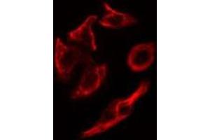 ABIN6278818 staining HepG2 cells by IF/ICC. (COL9A1 anticorps  (Internal Region))