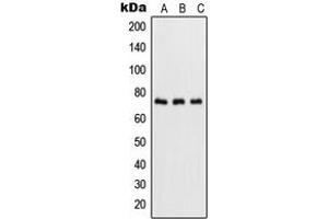 Western blot analysis of NF-kappaB p65 (pS536) expression in HeLa TNFa-treated (A), NIH3T3 LPS-treated (B), rat brain (C) whole cell lysates. (NF-kB p65 anticorps  (C-Term, pSer536))
