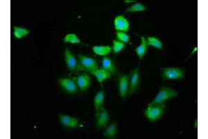 Immunofluorescence staining of Hela cells cells with ABIN7163449 at 1: 200, counter-stained with DAPI. (PIH1D1 anticorps  (AA 1-290))