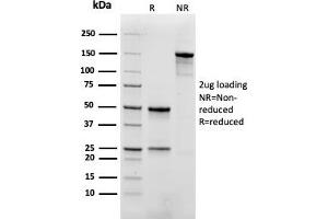 SDS-PAGE Analysis. (Recombinant Myoglobin anticorps)
