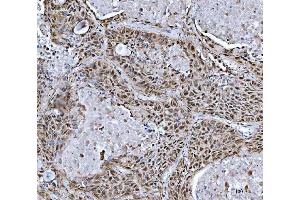 anti-RNA (Guanine-9-) Methyltransferase Domain Containing 1 (RG9MTD1) (AA 36-340) antibody