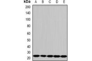 Western blot analysis of PCMT1 expression in HepG2 (A), A431 (B), mouse liver (C), rat brain (D), rat heart (E) whole cell lysates. (PCMT1 anticorps)