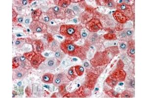 Image no. 1 for anti-Formiminotransferase Cyclodeaminase (FTCD) (N-Term) antibody (ABIN374453) (FTCD anticorps  (N-Term))