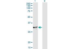 Western Blot analysis of SPR expression in transfected 293T cell line by SPR monoclonal antibody (M01), clone 4F2. (SPR anticorps  (AA 164-260))
