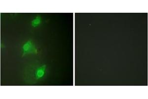 Immunofluorescence analysis of HeLa cells, using AIRE antibody.