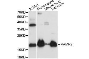 Western blot analysis of extracts of various cell lines, using VAMP2 antibody (ABIN1875306) at 1:3000 dilution. (VAMP2 anticorps)