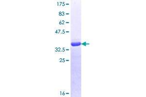 Image no. 1 for UPF1 Regulator of Nonsense Transcripts Homolog (UPF1) (AA 1019-1116) protein (GST tag) (ABIN1324684)