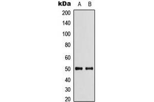 Western blot analysis of ENT2 expression in HEK293T (A), Raw264. (SLC29A2 anticorps  (Center))