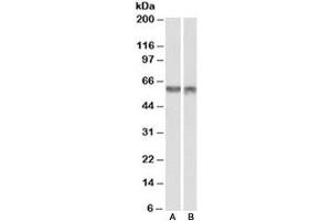 Western blot testing of nuclear mouse NIH3T3 [A] and nuclear human HeLa [B] lysates with PDCD4 antibody at 1ug/ml. (PDCD4 anticorps)