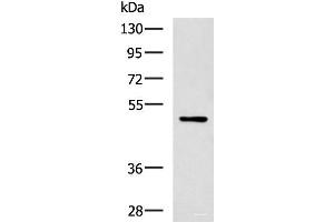 Western blot analysis of MCF-7 cell lysate using PAX2 Polyclonal Antibody at dilution of 1:400 (PAX2A anticorps)