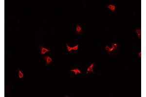 ABIN6266906 staining K-562 cells by IF/ICC. (HSPH1 anticorps  (C-Term))