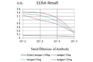 Black line: Control Antigen (100 ng),Purple line: Antigen (10 ng), Blue line: Antigen (50 ng), Red line:Antigen (100 ng)