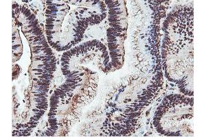 Image no. 2 for anti-Proteasome (Prosome, Macropain) Subunit, beta Type, 7 (PSMB7) (AA 58-277) antibody (ABIN1491598)