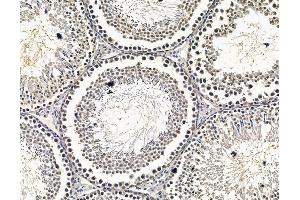 ABIN7096587 and ABIN7100651 at 1/100 staining rat testis tissue by IHC-P. (CTC1 anticorps)
