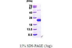 DCMP Deaminase (DCTD) (AA 1-178) protein (His tag)