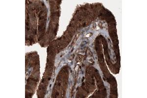 Immunohistochemical staining (Formalin-fixed paraffin-embedded sections) of human fallopian tube with PFN1 monoclonal antibody, clone CL3524  shows cytoplasmic immunoreactivity in epithelial cells. (PFN1 anticorps)
