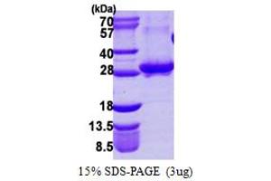 SDS-PAGE (SDS) image for RAB3A, Member RAS Oncogene Family (RAB3A) (AA 1-220) protein (His tag) (ABIN7279483) (RAB3A Protein (AA 1-220) (His tag))